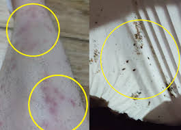 빈대 침입 징후와 모습