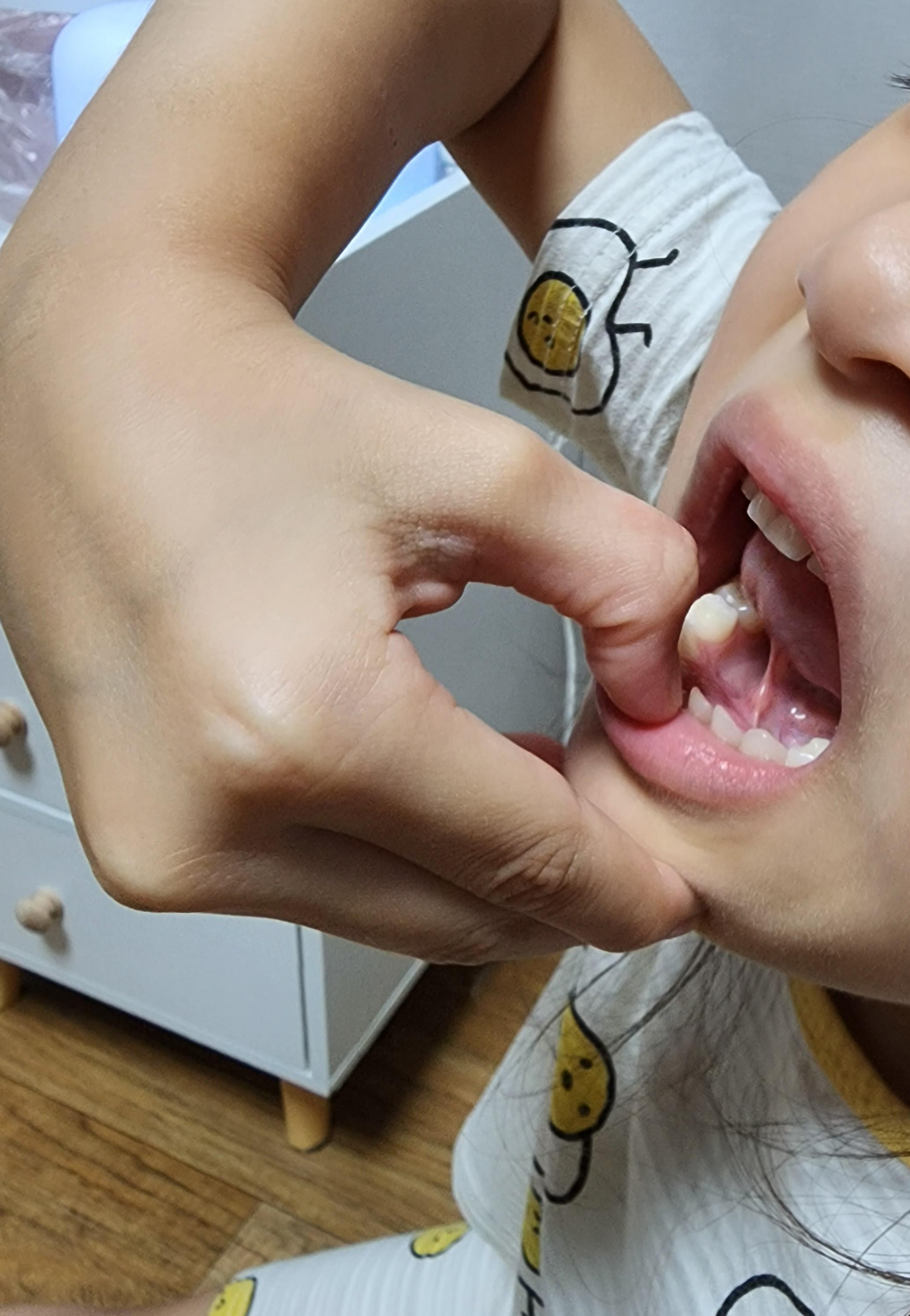 안아프게이빨뽑기