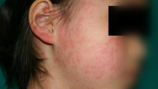 유형별 원인과 특징