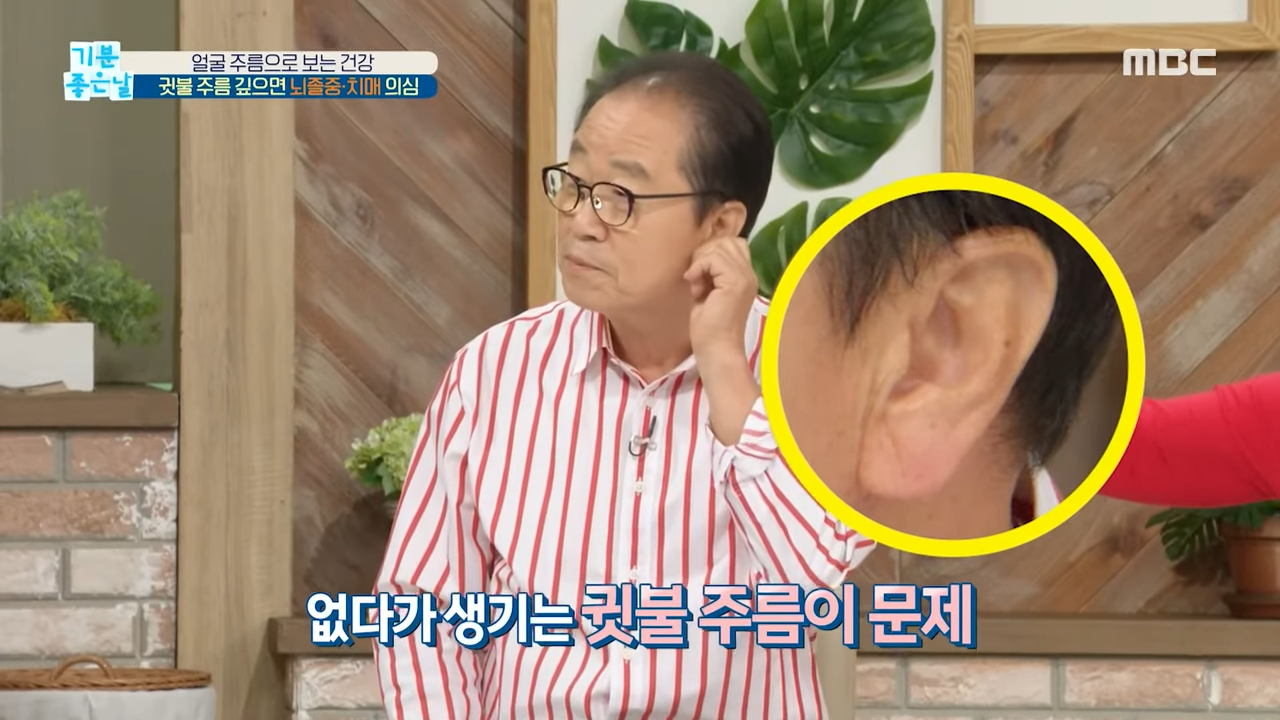 귓볼주름