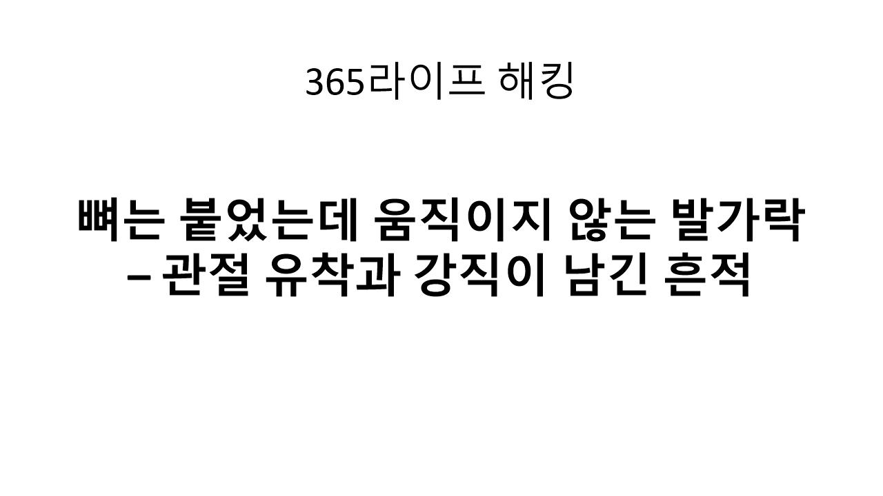 뼈는 붙었지만 발가락이 굳었다? 관절 유착의 정체