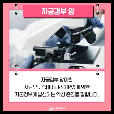 자궁경부암 반응성 세포변화