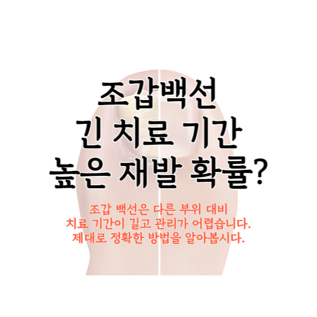 조갑백선