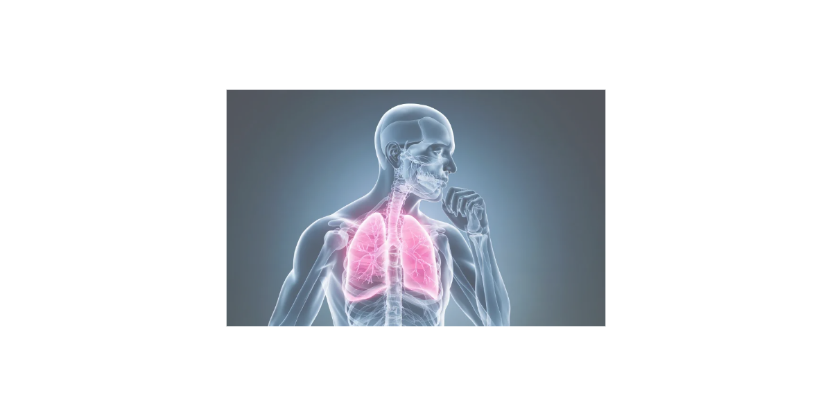 폐렴 관련 사진