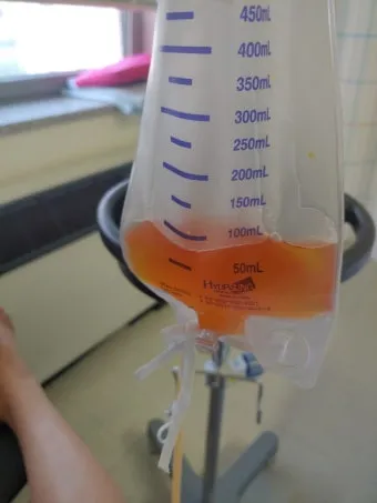 폐에 물이 차는 원인 증상 물참 관리 포인트에 대한 건강정보_15