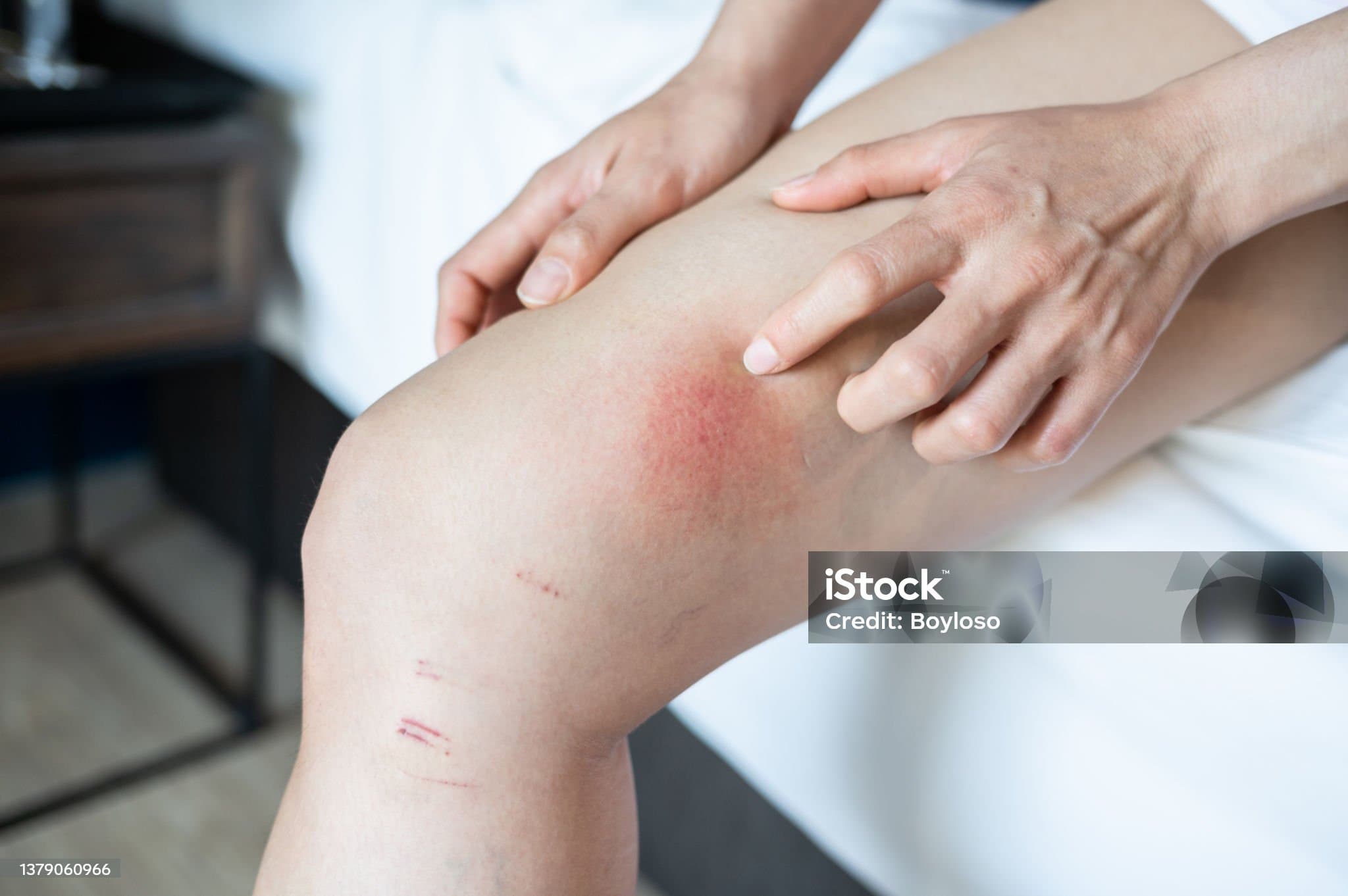 다리가 가려운 이유 무엇일까