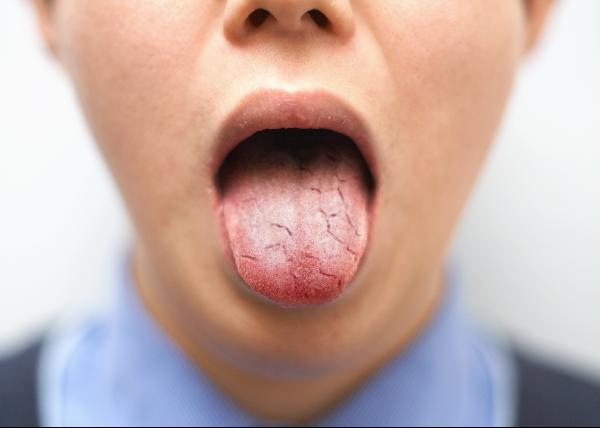 술과 탈수 증상