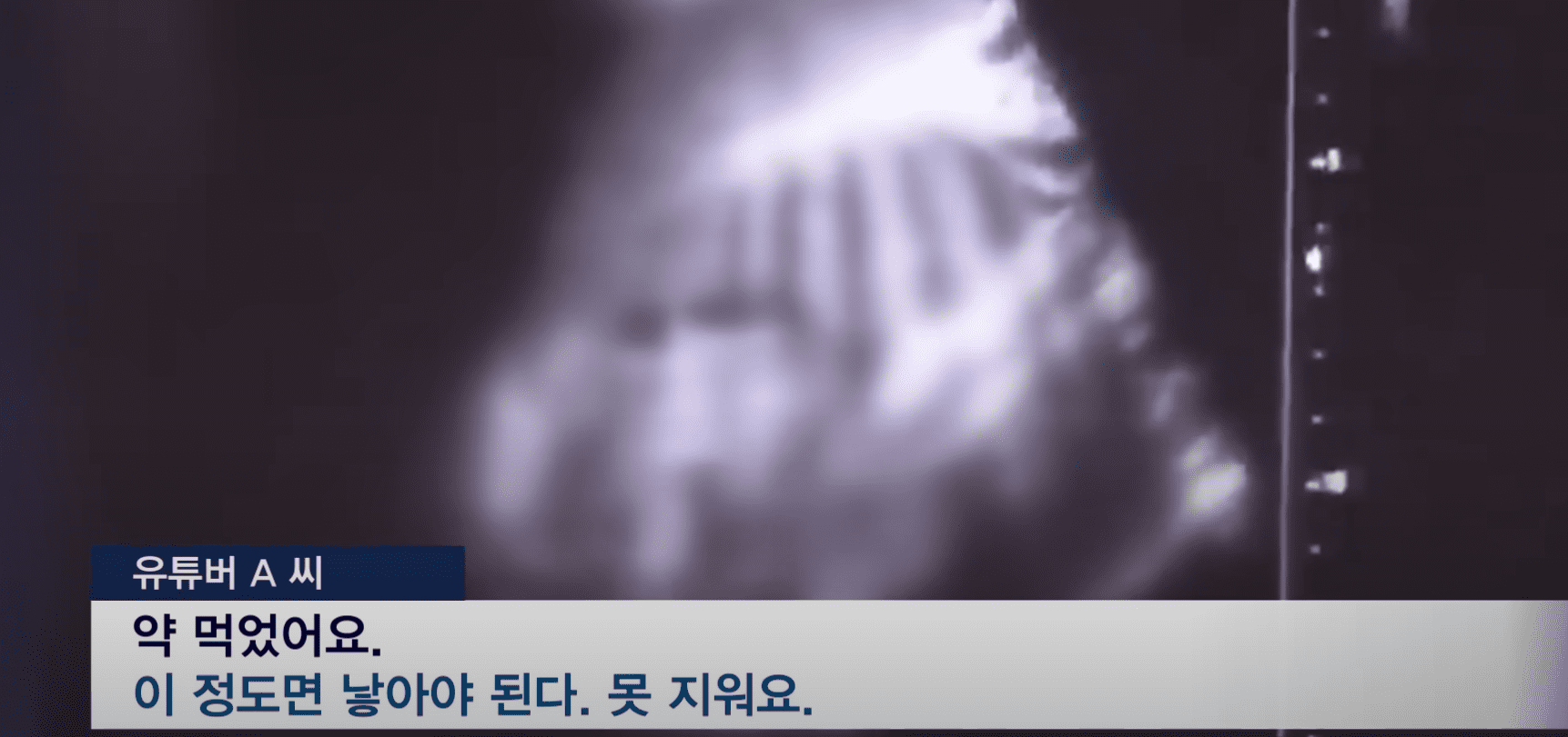 36주 태아 유튜버 논란 정리