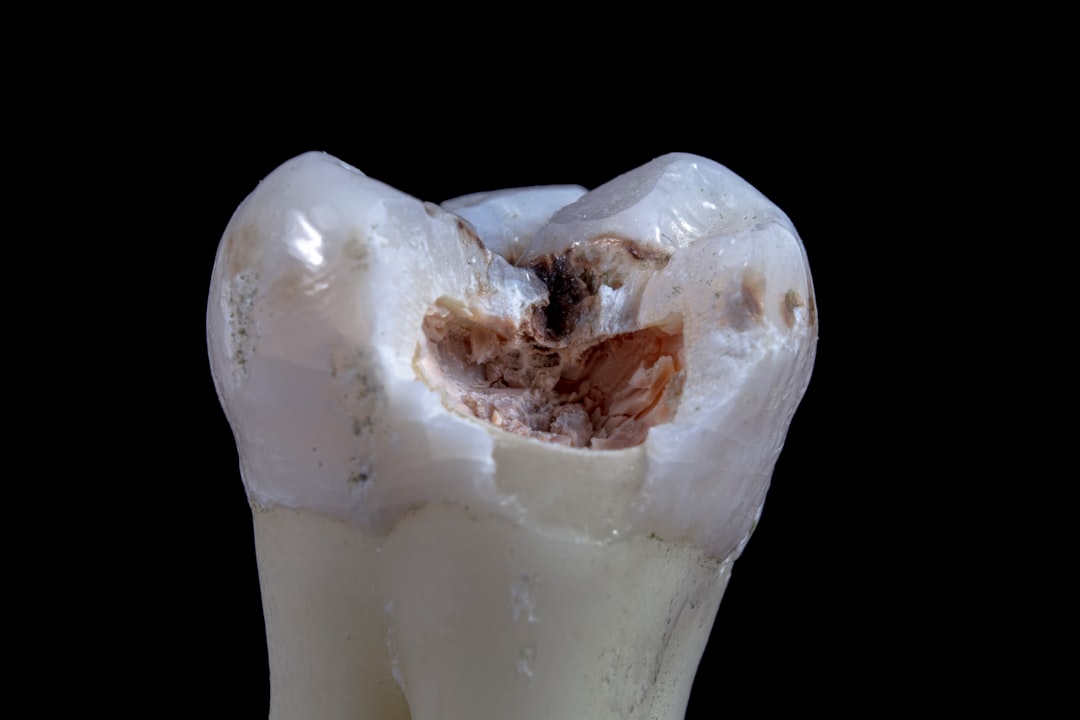 Tooth.