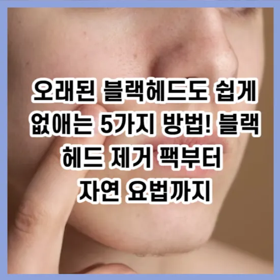 오래된 블랙헤드 쉽게 없애는 5가지방법