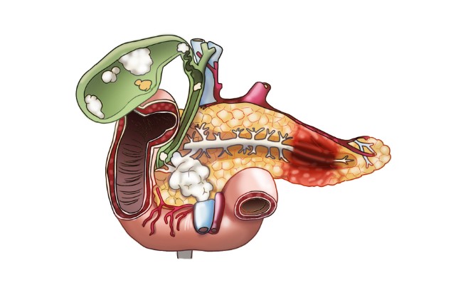 인슐린의 역할, 혈당 수치, 치료법