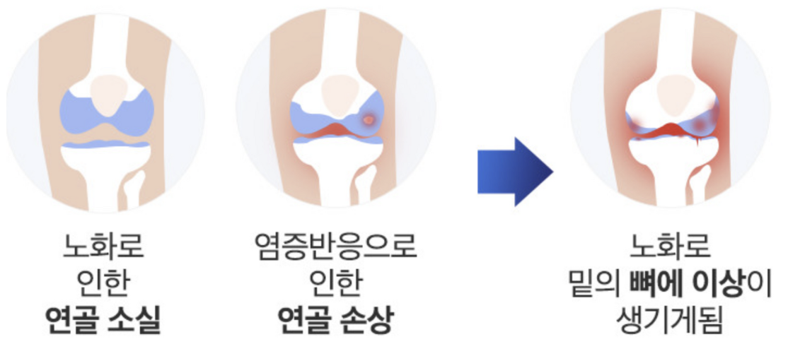 콘드로이친-1200mg-효능-효과