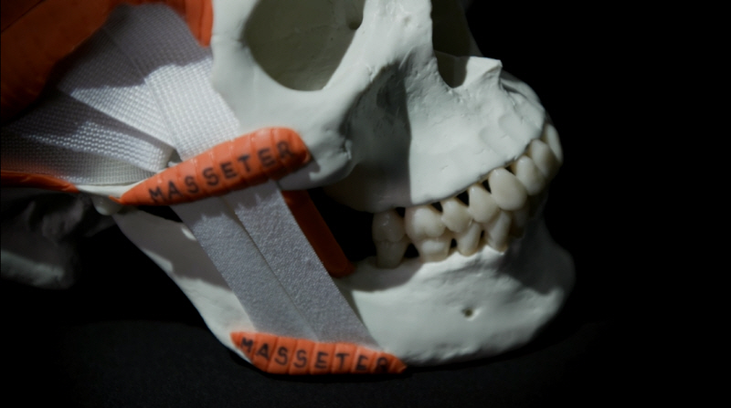 생로병사의 비밀