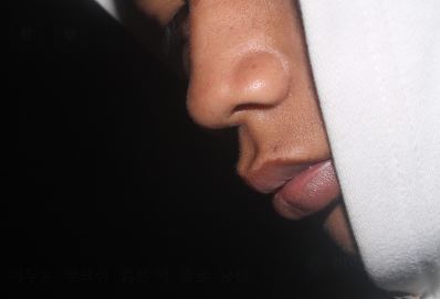 코와 입만 보이는 얼굴옆면 사진