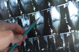 무료건강검진 대상자 조회