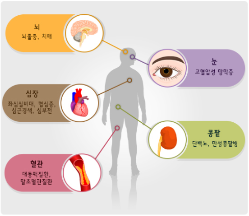 고혈압의 합병증