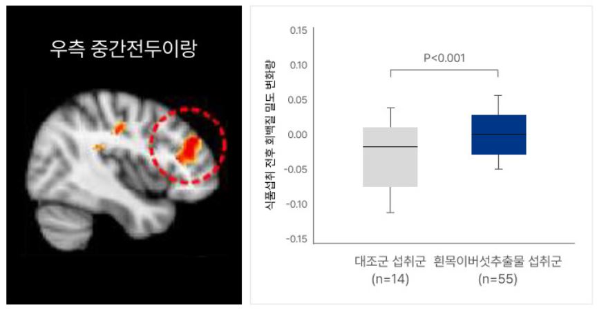 흰목이버섯 효소분해추출물의 특징,효능, 제품추천