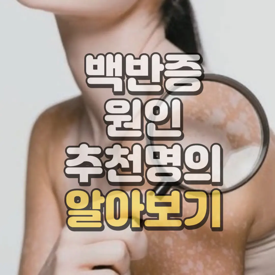 백반증 원인 치료방법 명의 추천