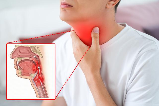 위산 역류 증상 목이 묵직한 느낌