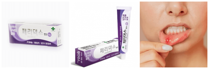 페리덱스 연고, 구내염 사진