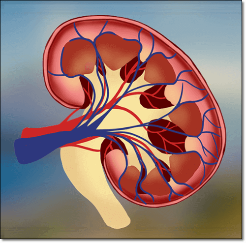 다낭성 신장 질환 이미지
