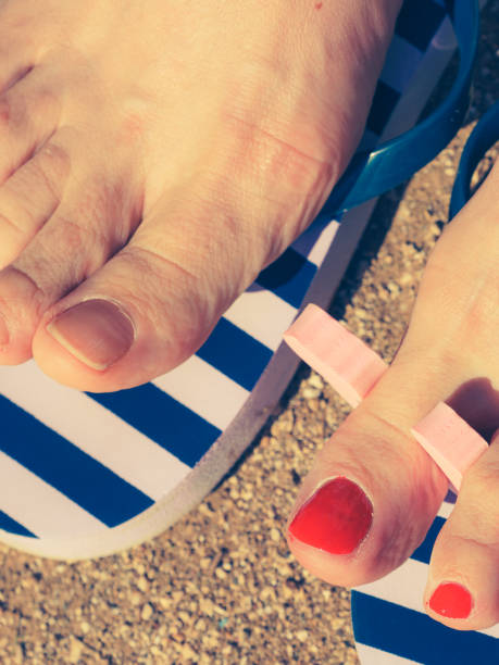 손톱 검은 세로줄