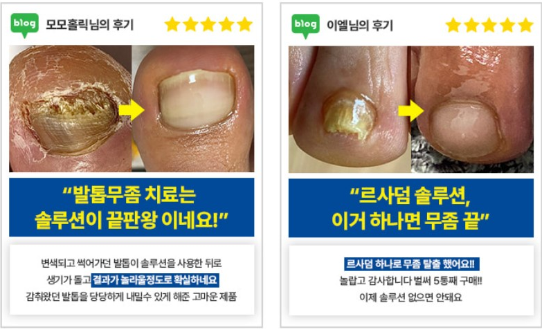 르사덤 발무조메 솔루션