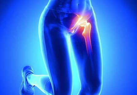 고관절 통증 원인
