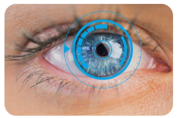 인공수정체-종류