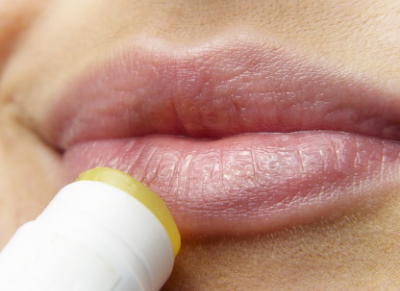 건조한 입술 (출처 : pixabay)