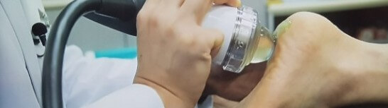 체외충격파 치료 중