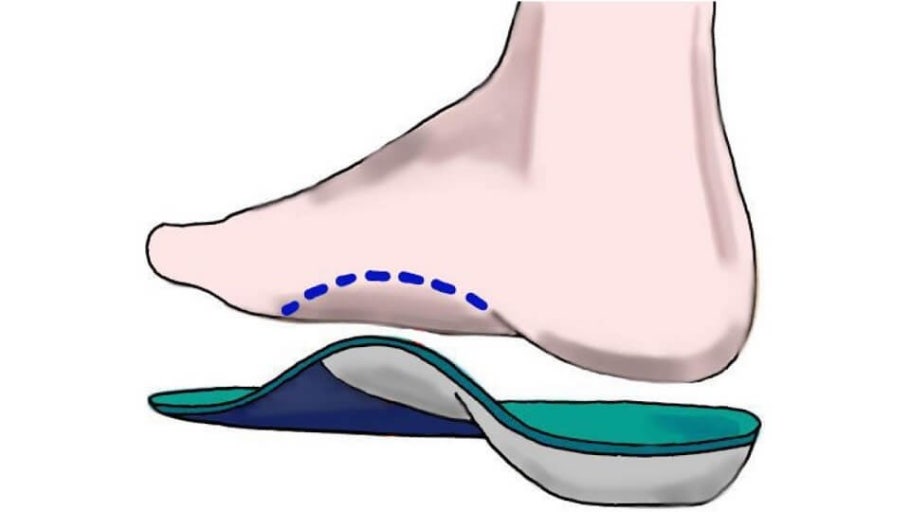 족저근막염의 증상 및 원인, 치료방법