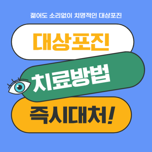 대상포진 즉시대처