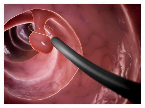 위내시경-금식시간
