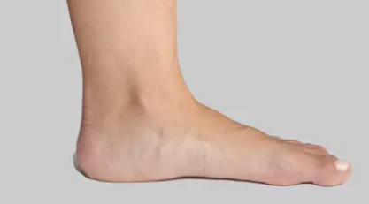 발바닥통증의 원인 12