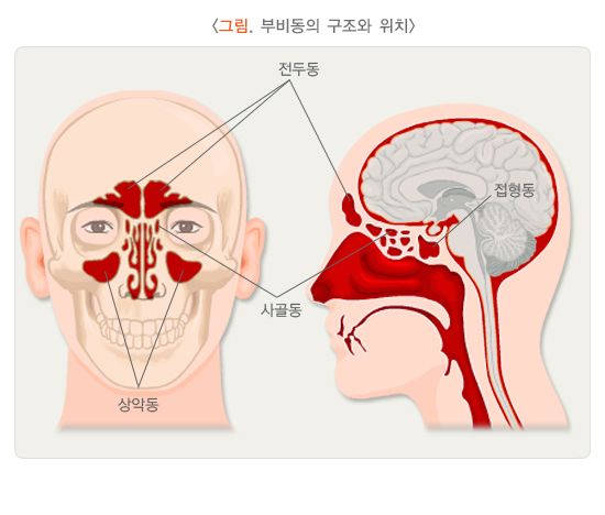 축농증 증상