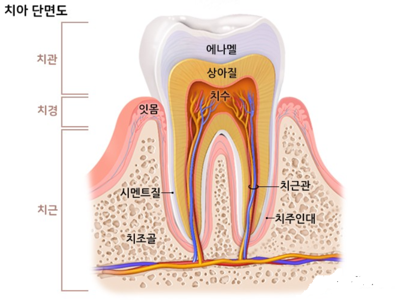 치주염 및 치아 단면도