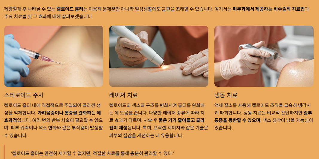 피부과의 켈로이드 치료 방법