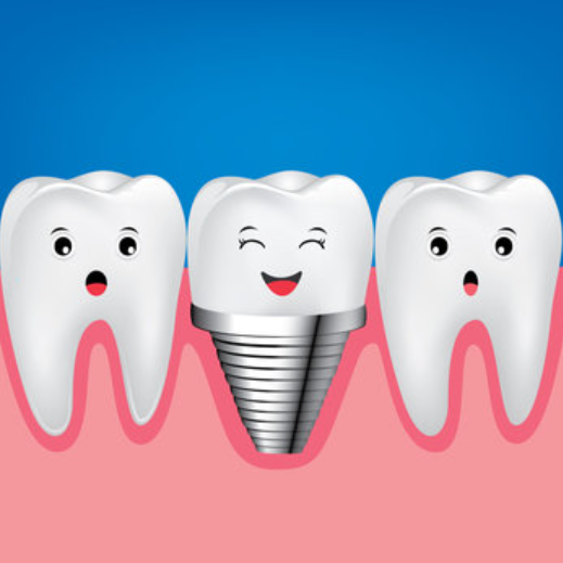 임플란트 가격 (2025년)