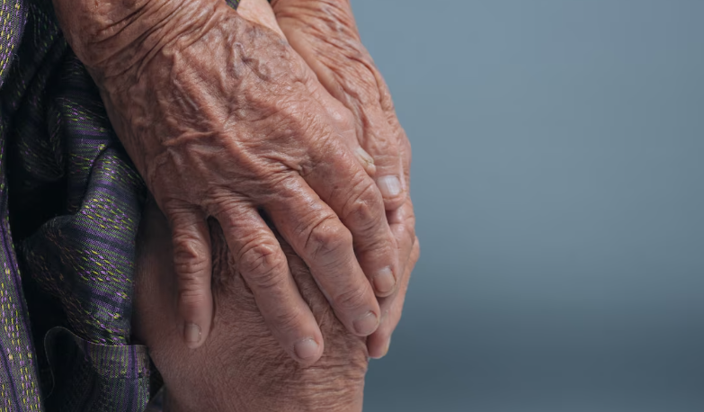 엔로스 단로스 증후군