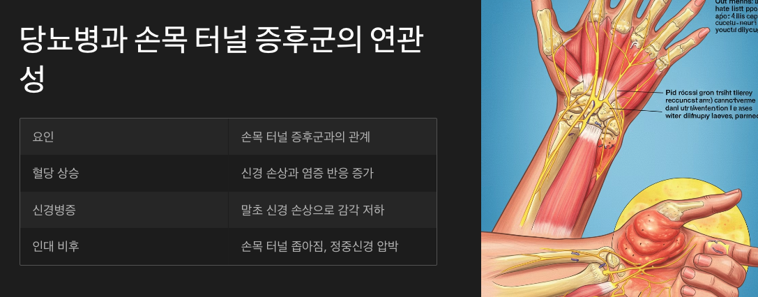 당뇨병과 손목 터널 증후군의 연관성