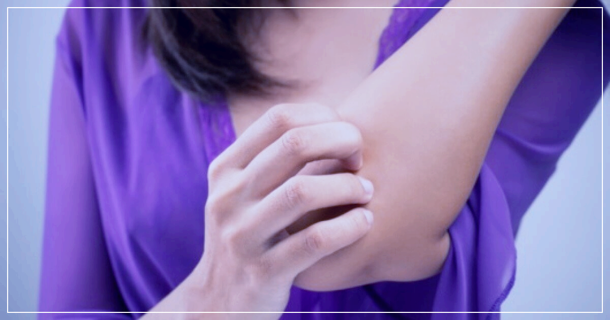 모공각화증 원인과 치료방법