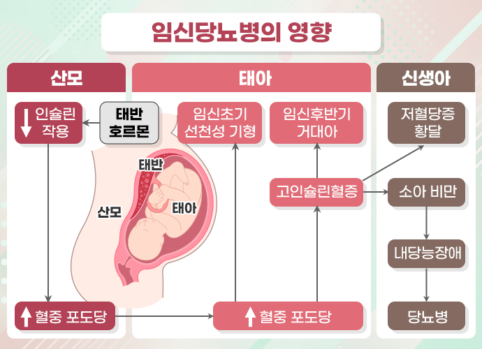 임신성 당뇨 관련 이미지