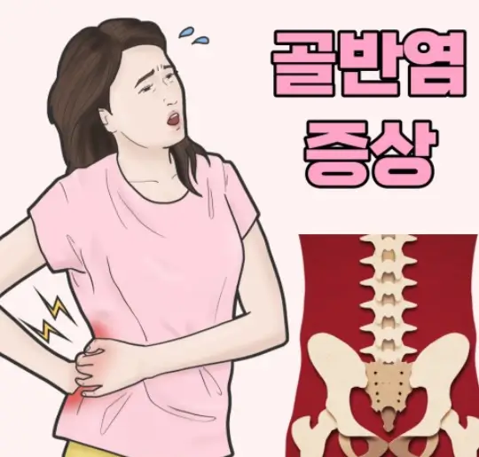 골반염