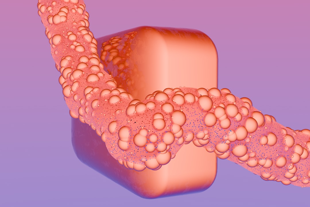 Crohn's disease.