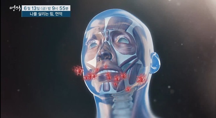 명의-폐질환
