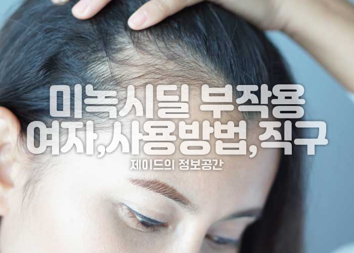 미녹시딜 부작용, 여자, 사용방법, 가격, 직구