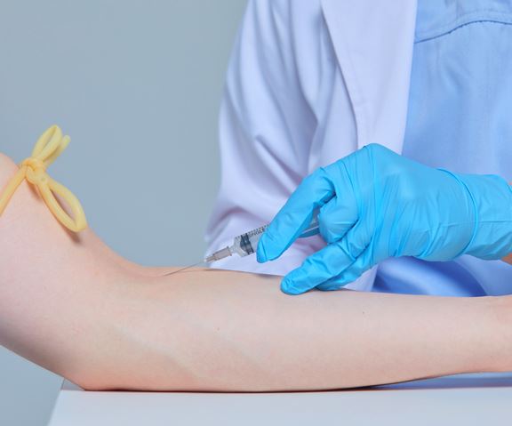 빌리루빈-정상수치