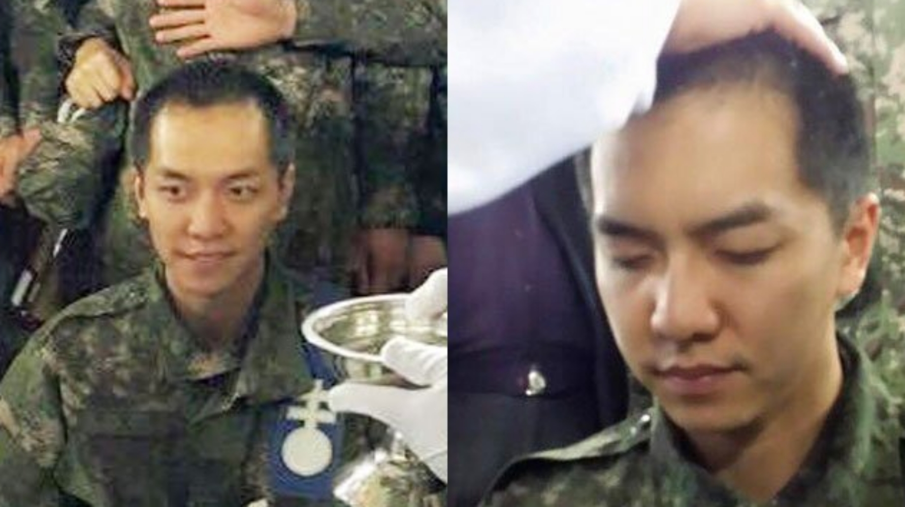 앞머리-탈모-복구