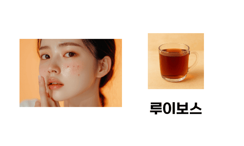 루이보스